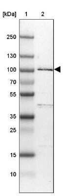 Western Blot: R3HDM2 Antibody [NBP1-81448]