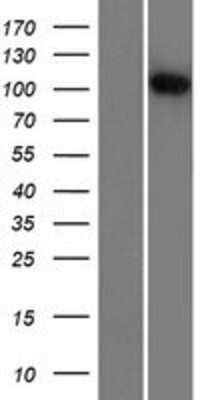 Western Blot: R3HDM2 Overexpression Lysate [NBP2-07247]