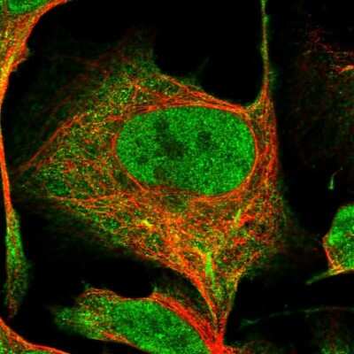 Immunocytochemistry/ Immunofluorescence: R3HDM4 Antibody [NBP2-37902]