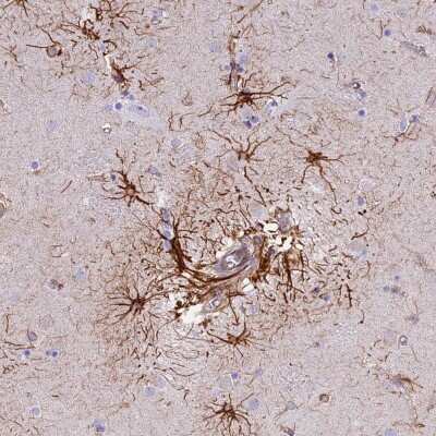 Immunohistochemistry: R3HDM4 Antibody [NBP2-37902]