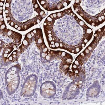 Immunohistochemistry: R3HDM4 Antibody [NBP2-37924]