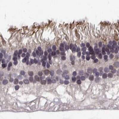 Immunohistochemistry-Paraffin: R9AP Antibody [NBP2-48946]