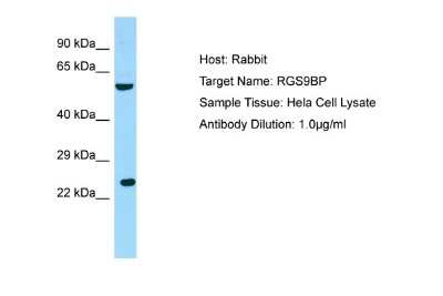 Western Blot: R9AP Antibody [NBP1-98304]