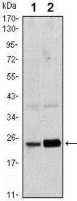 Western Blot: RAB10 Antibody (4E2)BSA Free [NBP1-51634]