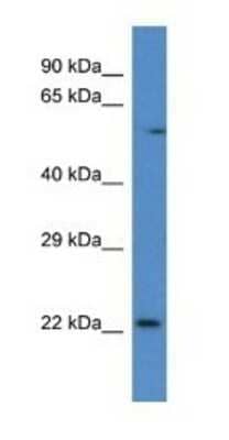 Western Blot: RAB10 Antibody [NBP1-74132]