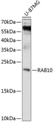 Western Blot: RAB10 AntibodyBSA Free [NBP2-93110]