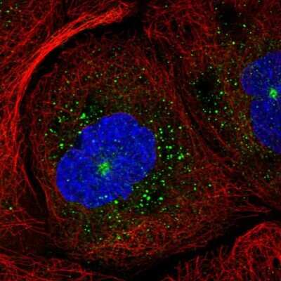 Immunocytochemistry/ Immunofluorescence: RAB11B Antibody [NBP2-58127]