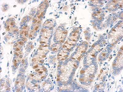 Immunohistochemistry-Paraffin: RAB11B Antibody [NBP2-15085]
