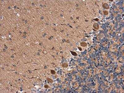 Immunohistochemistry-Paraffin: RAB11B Antibody [NBP2-15085]