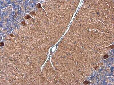 Immunohistochemistry-Paraffin: RAB11B Antibody [NBP2-15085]