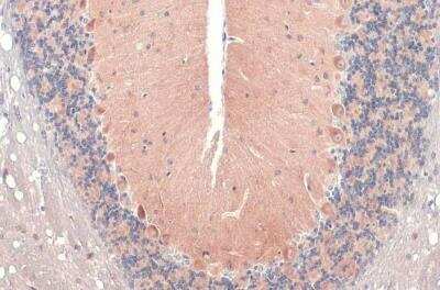 Immunohistochemistry-Paraffin: RAB11B Antibody [NBP2-15085]