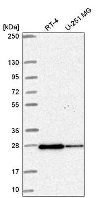 Western Blot: RAB11B Antibody [NBP2-58127]