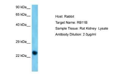 Western Blot: RAB11B Antibody [NBP2-85568]