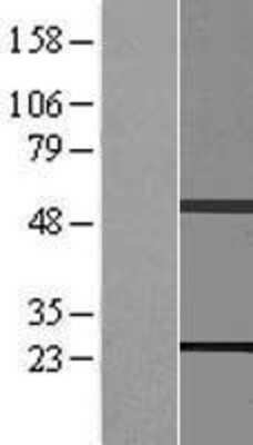 Western Blot: RAB11B Overexpression Lysate [NBP2-07896]