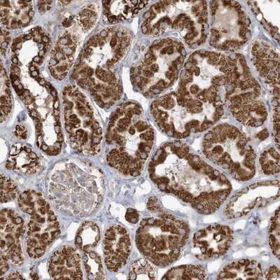 Immunohistochemistry-Paraffin: RAB11FIP3 Antibody [NBP1-83998]