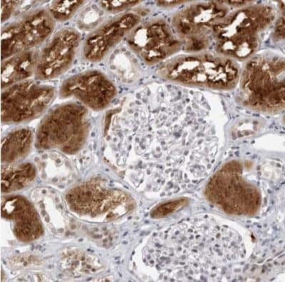 Immunohistochemistry-Paraffin: RAB11FIP3 Antibody [NBP1-83999]