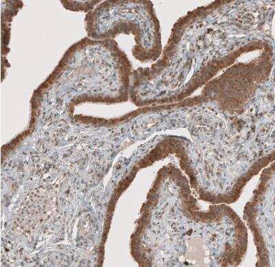 Immunohistochemistry-Paraffin: RAB11FIP3 Antibody [NBP1-84000]
