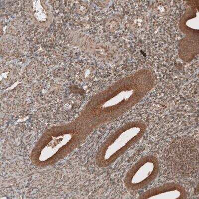 Immunohistochemistry-Paraffin: RAB11FIP3 Antibody [NBP1-84000]