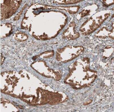Immunohistochemistry-Paraffin: RAB11FIP3 Antibody [NBP1-84000]