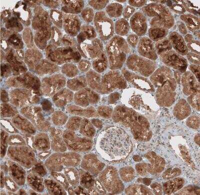 Immunohistochemistry-Paraffin: RAB11FIP3 Antibody [NBP1-84000]