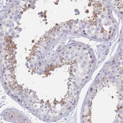 Immunohistochemistry-Paraffin: RAB11FIP4 Antibody [NBP2-13187]