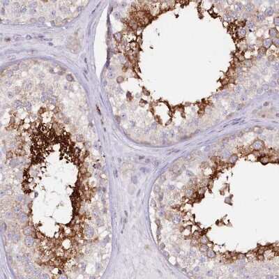 Immunohistochemistry-Paraffin: RAB11FIP5 Antibody [NBP2-32662]