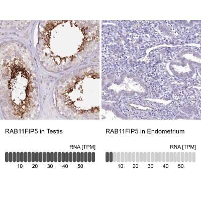 Immunohistochemistry-Paraffin: RAB11FIP5 Antibody [NBP2-32662]