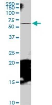 Western Blot: RAB11FIP5 Antibody [H00026056-B01P]