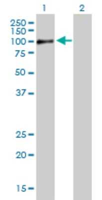 Western Blot: RAB11FIP5 Antibody [H00026056-B01P]