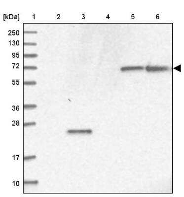 Western Blot: RAB11FIP5 Antibody [NBP1-81855]