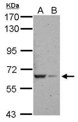 Western Blot: RAB11FIP5 Antibody [NBP2-20035]