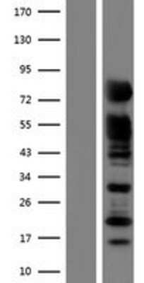 Western Blot: RAB11FIP5 Overexpression Lysate [NBP2-07165]