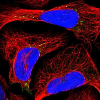 Immunocytochemistry/ Immunofluorescence: RAB12 Antibody [NBP1-90976]