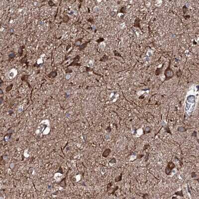 Immunohistochemistry-Paraffin: RAB12 Antibody [NBP1-90976]