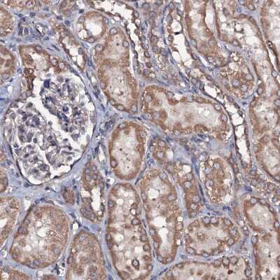 Immunohistochemistry-Paraffin: RAB12 Antibody [NBP1-90976]