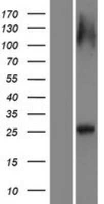 Western Blot: RAB12 Overexpression Lysate [NBP2-08632]