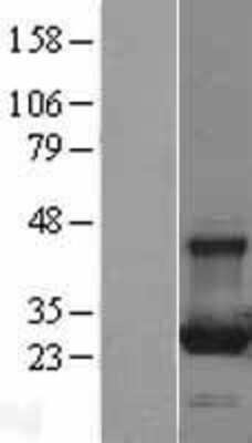 Western Blot: Rab13 Overexpression Lysate [NBL1-15040]