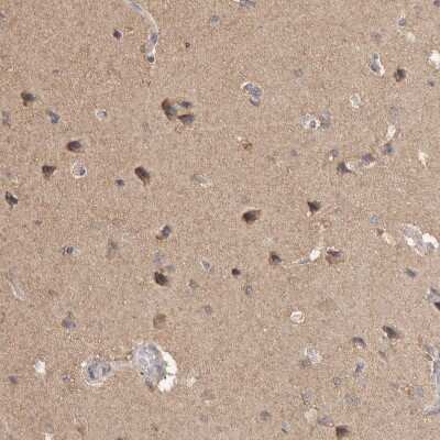 Immunohistochemistry-Paraffin: RAB14 Antibody [NBP1-84720]