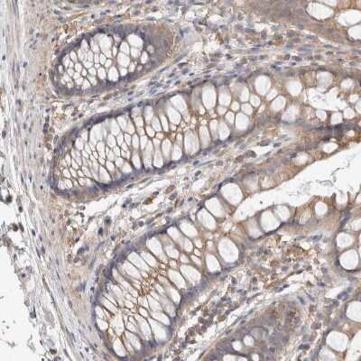 Immunohistochemistry-Paraffin: RAB14 Antibody [NBP1-84720]