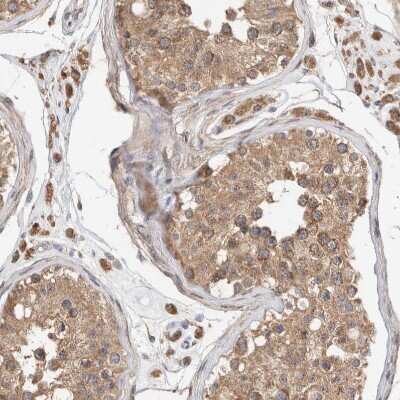 Immunohistochemistry-Paraffin: RAB14 Antibody [NBP1-84720]