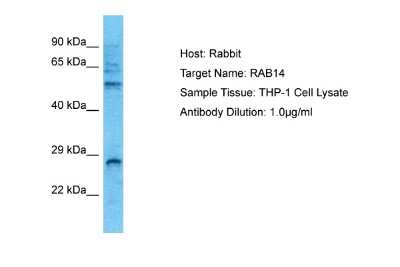 Western Blot: RAB14 Antibody [NBP2-85571]