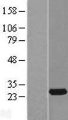 Western Blot: RAB14 Overexpression Lysate [NBL1-15041]