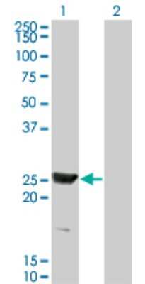 Western Blot: RAB15 Antibody (1G12) [H00376267-M01]