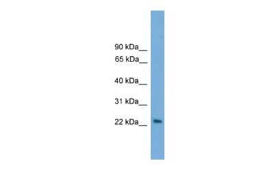 Western Blot: RAB15 Antibody [NBP2-88108]