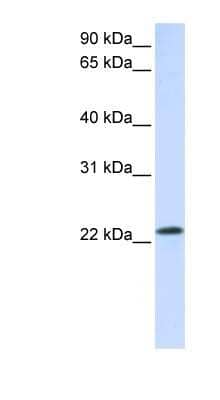 Western Blot: RAB18 Antibody [NBP1-58863]