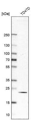 Western Blot: RAB18 Antibody [NBP1-85966]