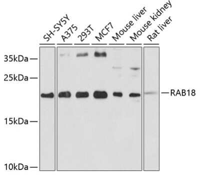 Western Blot: RAB18 AntibodyBSA Free [NBP2-94103]