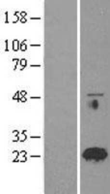 Western Blot: RAB18 Overexpression Lysate [NBL1-15044]