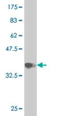 Western Blot: RAB19B Antibody (4E2) [H00401409-M01]