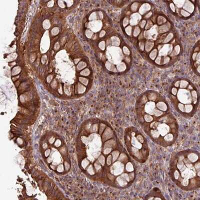 Immunohistochemistry-Paraffin: RAB19B Antibody [NBP2-13188]